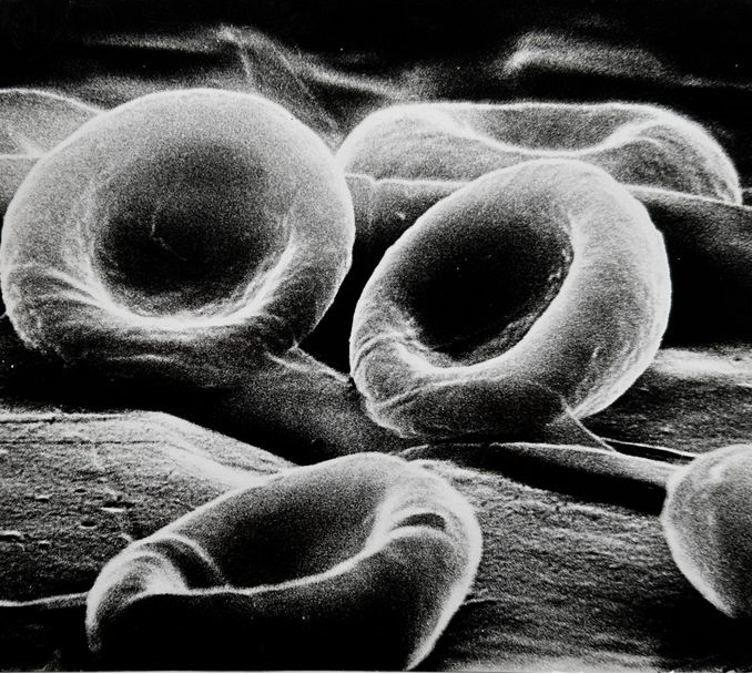 Red blood cells under electron microscope